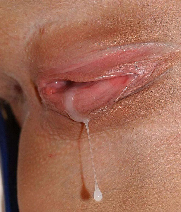 18+