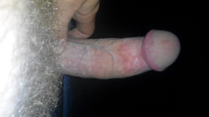 dick