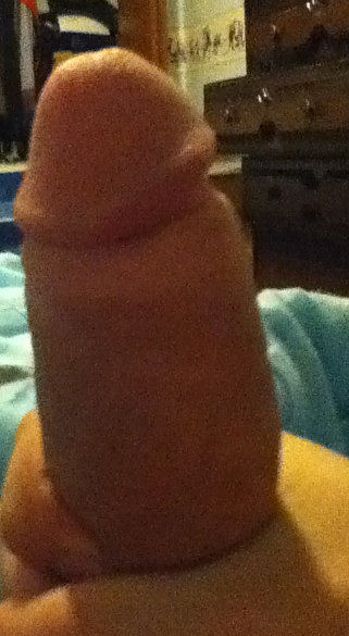 Penis