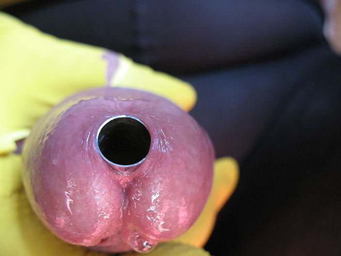 разширитель