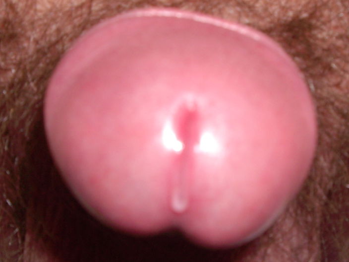 tear1