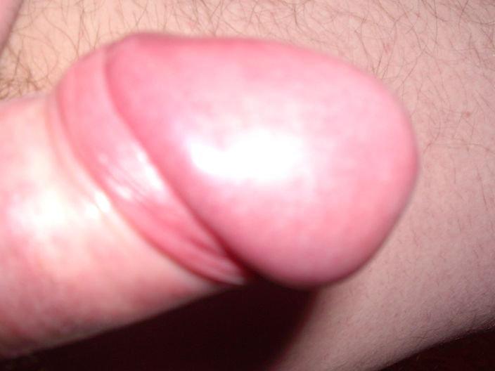tear4